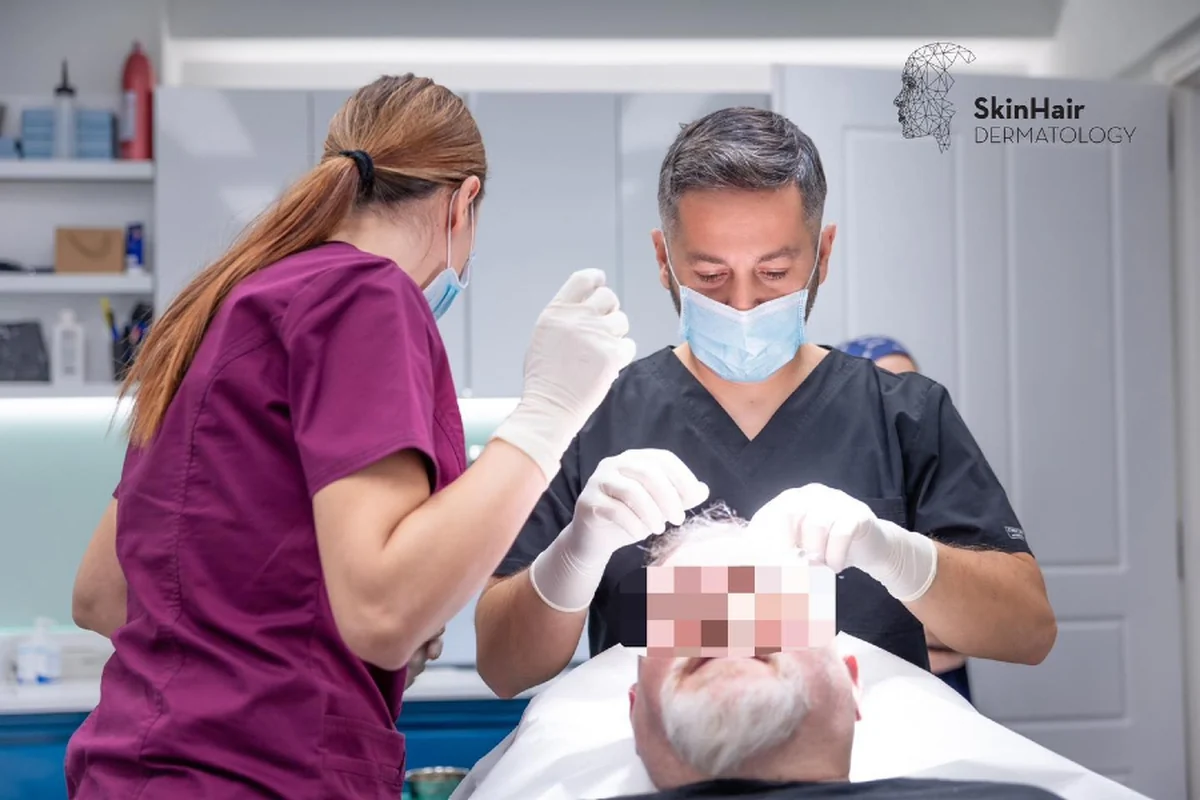 Προετοιμασία πριν από τη μεταμόσχευση μαλλιών